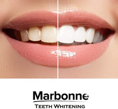 Marbonne™ Teeth Whitening Strips